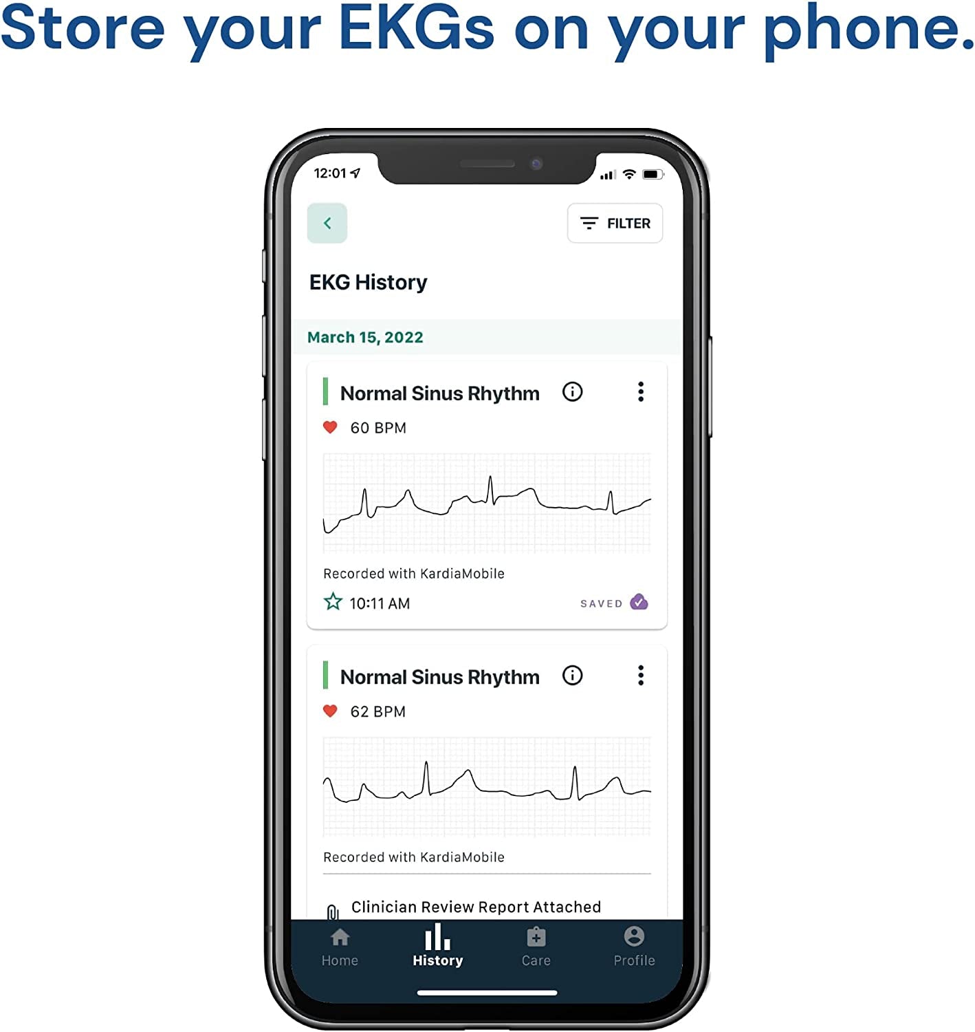 ECG Monitor: Wireless Personal Device to Detect Afib from Home in 30 Seconds. Easy to Use, Compatible with Most Smartphones, and FSA/HSA Eligible.