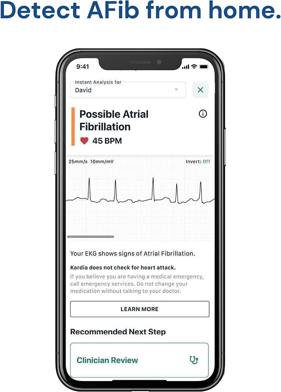 ECG Monitor: Wireless Personal Device to Detect Afib from Home in 30 Seconds. Easy to Use, Compatible with Most Smartphones, and FSA/HSA Eligible.